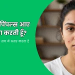 चेहरे पर पिंपल्स
